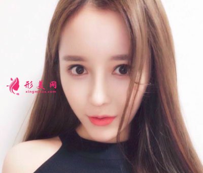 上海喜美醫(yī)療美容鼻部修復(fù)案例
