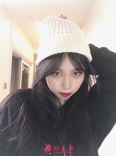 成都藝星周順波隆鼻效果怎么樣_假體硅膠隆鼻_真人案例