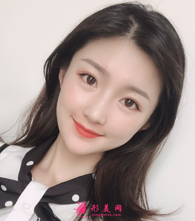 成都華美、藝星、美萊做面部自體脂肪填充怎么樣？哪個醫(yī)生好