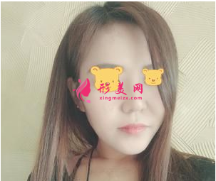 成都成美鄭敏做鼻子怎么樣？