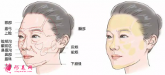 自體脂肪填充臉部需要多久恢復(fù)好？