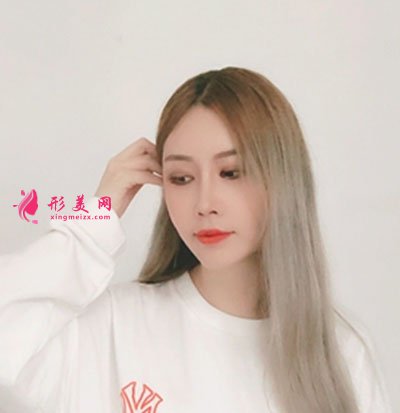 成都菲格隆鼻手術案例