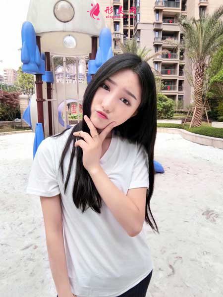 雙眼皮修復(fù)術(shù)后30天