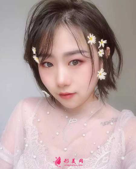 熱拉提手術后60天