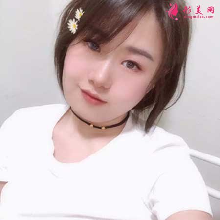 熱拉提手術前