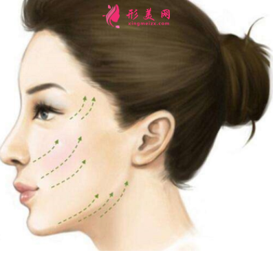 埋線提升后要休息多久