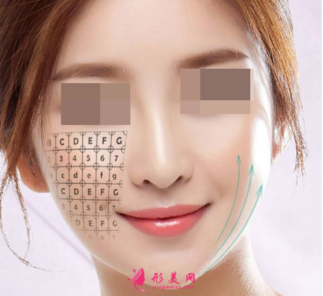 面部埋線提升可以保持多久