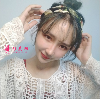 武漢美亞整形醫(yī)院劉佳亮雙眼皮