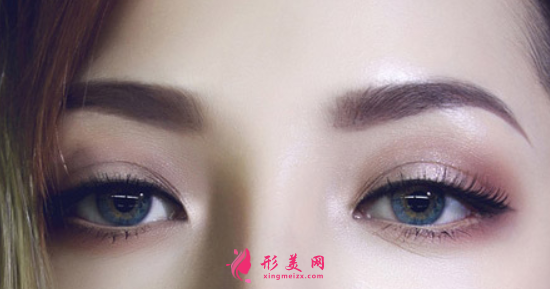 雙眼皮手術(shù)失敗什么時候修復(fù)比較好