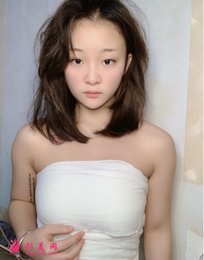 北京知音整形醫(yī)院劉東升隆胸