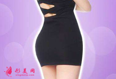 臀部吸脂術(shù)后會(huì)松弛下垂嗎