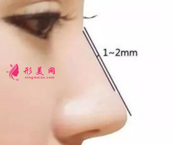 假體隆鼻什么時(shí)候更換比較好