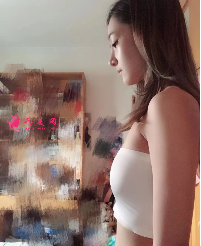 武漢藝星雷云飛假體隆胸 武漢藝星雷云飛假體隆胸
