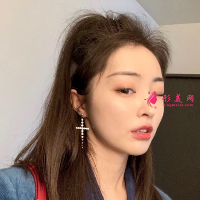 武漢華亞整形醫(yī)院李愛林面部除皺