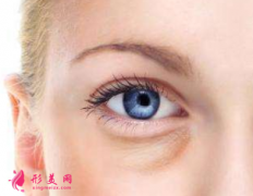 手術(shù)祛眼袋會(huì)不會(huì)有后遺癥？