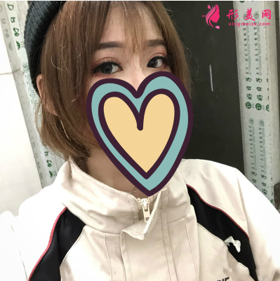 湖北省中醫(yī)院整形科胡霜紅雙眼皮