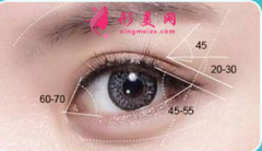 開眼角的創(chuàng)傷大不大？