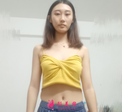 重慶美圣美邦整形醫(yī)院任志偉腰腹吸脂