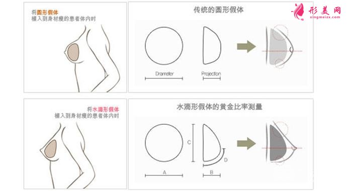 隆胸問題問答
