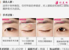 北京割雙眼皮多少錢？影響雙眼皮手術價格的因素