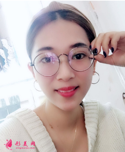武漢韓辰整形醫(yī)院李相奇雙眼皮案例
