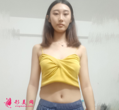 重慶美圣美邦整形醫(yī)院任志偉腰腹吸脂