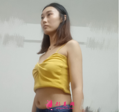 重慶美圣美邦整形醫(yī)院任志偉腰腹吸脂