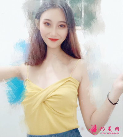 重慶美圣美邦整形醫(yī)院任志偉腰腹吸脂