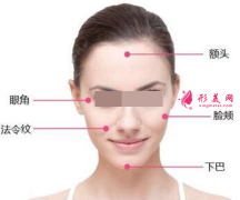 面部埋線提升腫脹期多久？