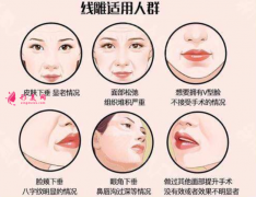 面部埋線提升有風險嗎？