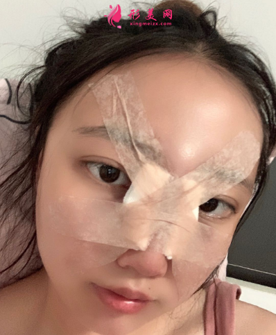 上海東方麗人整形醫(yī)院喬海初隆鼻
