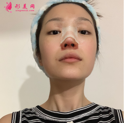 武漢韓辰整形醫(yī)院牛永敢隆鼻技術(shù)