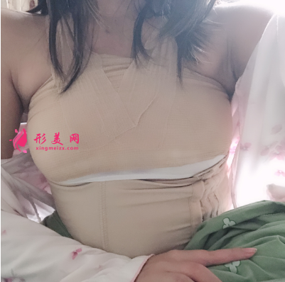 上海喜美整形醫(yī)院王會(huì)勇自體脂肪隆胸案例
