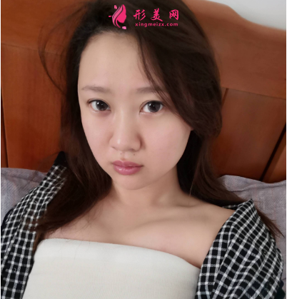 隆胸