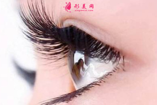 雙眼皮整形失敗了怎么辦