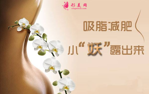 吸脂減肥有恢復(fù)期嗎