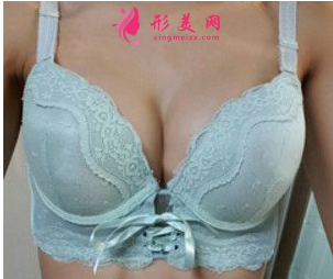 上海美聯(lián)臣整形醫(yī)院隆胸誰做的好？裴仁鎬假體隆胸90天效果很不錯(cuò)