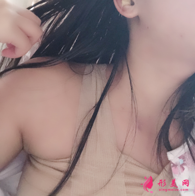 上海喜美整形醫(yī)院王會勇自體脂肪隆胸案例 上海喜美整形醫(yī)院王會勇自體脂肪隆胸案例
