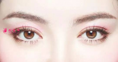 廣州美萊雙眼皮整形多少錢？