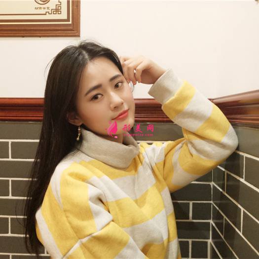 理想中的自己的整形術(shù)后圖片
