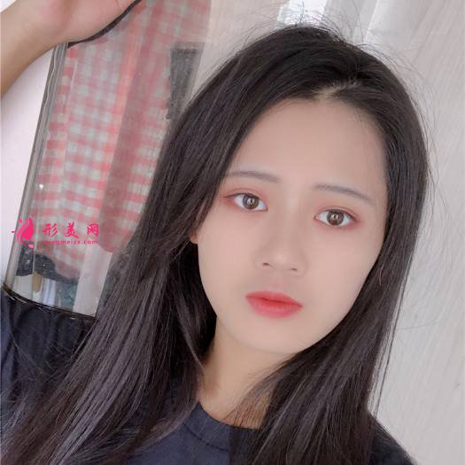 理想中的自己的整形術(shù)后圖片