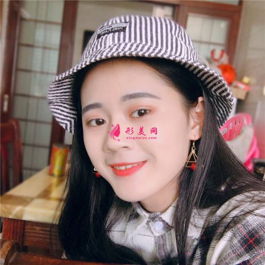 理想中的自己的整形術(shù)后圖片