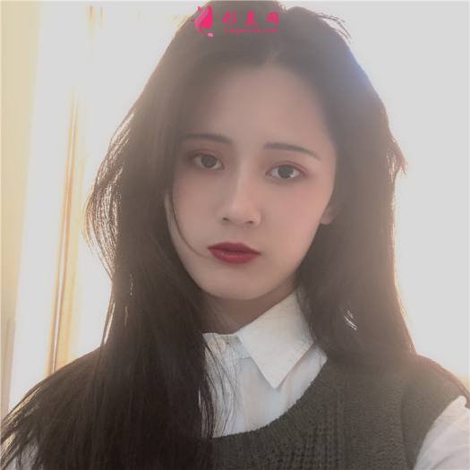 理想中的自己的整形術(shù)后圖片