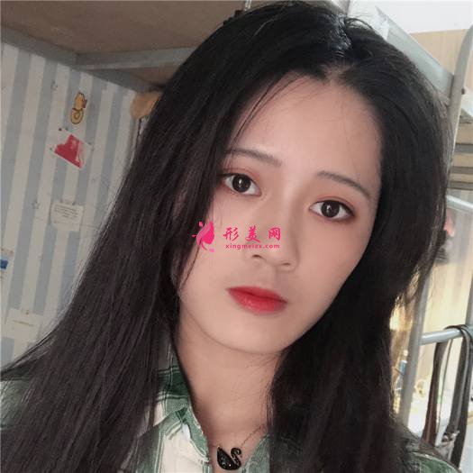 理想中的自己的整形術(shù)后圖片