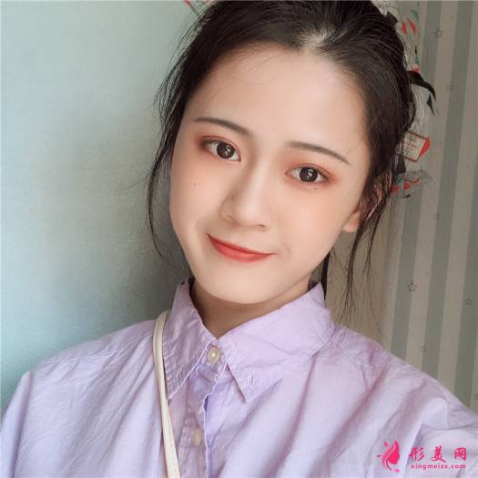 理想中的自己的整形術(shù)后圖片