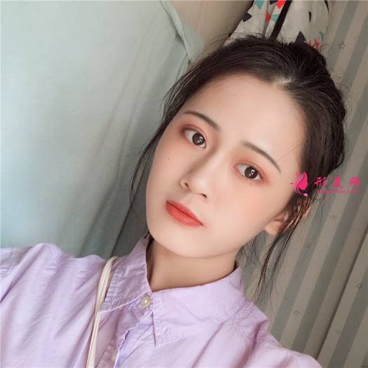 理想中的自己的整形術(shù)后圖片