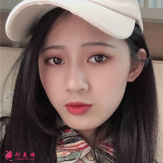 理想中的自己的整形術(shù)后圖片