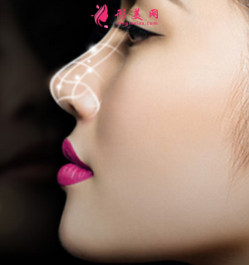 做假體隆鼻的價(jià)格貴不貴