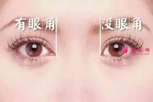 開(kāi)眼角失敗什么時(shí)候修復(fù)比較好