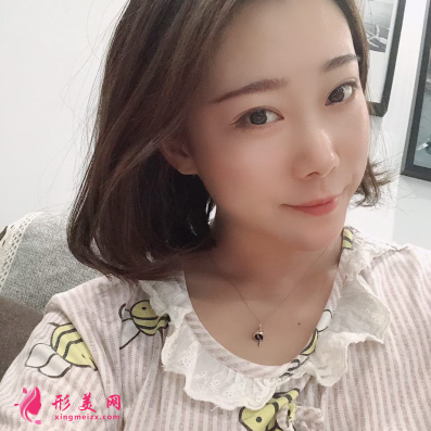 韓緣聚美做水氧活膚怎么樣呢？案例30天術(shù)后效果真的好極了